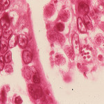 Flickr Toxoplasma gondii Microbe World CC.jpg