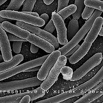 Flickr. NIAID. E. coli.jpg