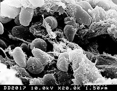 Yersinia pestis bacteria - Flickr autor NIAID