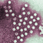 Archivo:Norovirus.jpg